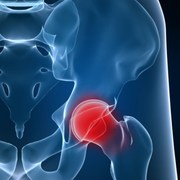 Arthritis related image